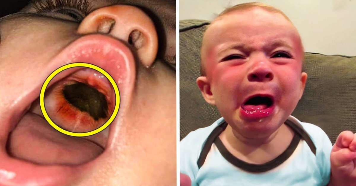 Doctors See Something in Baby’s Mouth when They find out what it was, it Leaves them in Awe