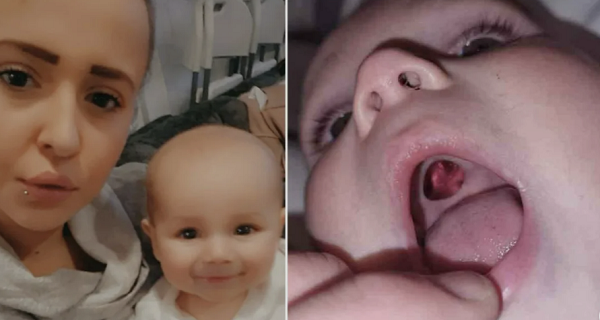 Mother reveals she rushed her 10-month-old son to hospital after spotting a ‘hole’ in the roof of his mouth that turned out to be a STICKER